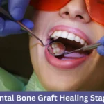 Dental Bone Graft Healing Stages