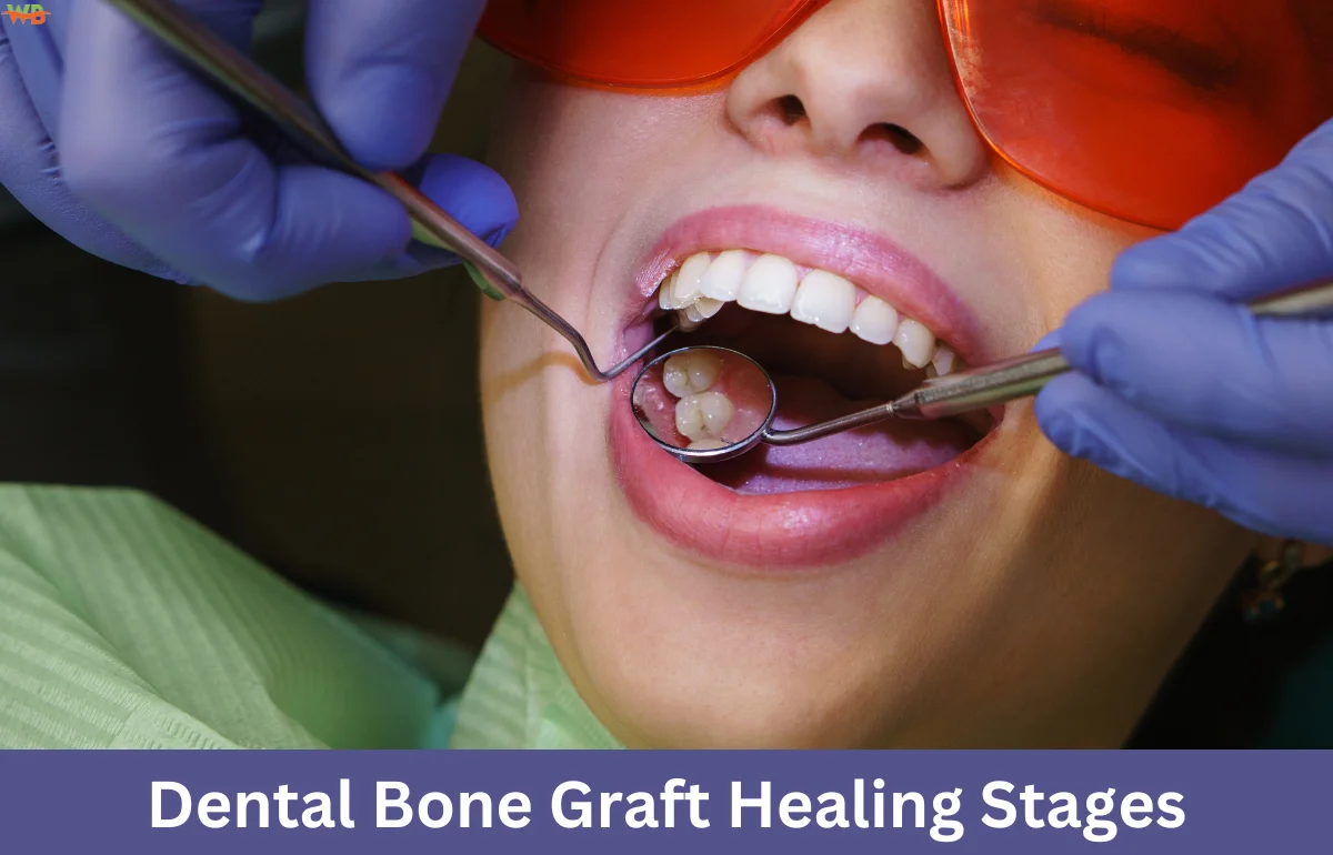 Dental Bone Graft Healing Stages