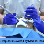 Dental Implants Covered by Medical Insurance