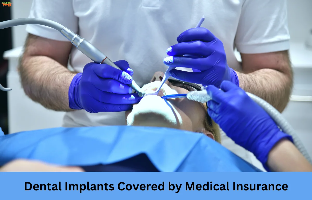 Dental Implants Covered by Medical Insurance